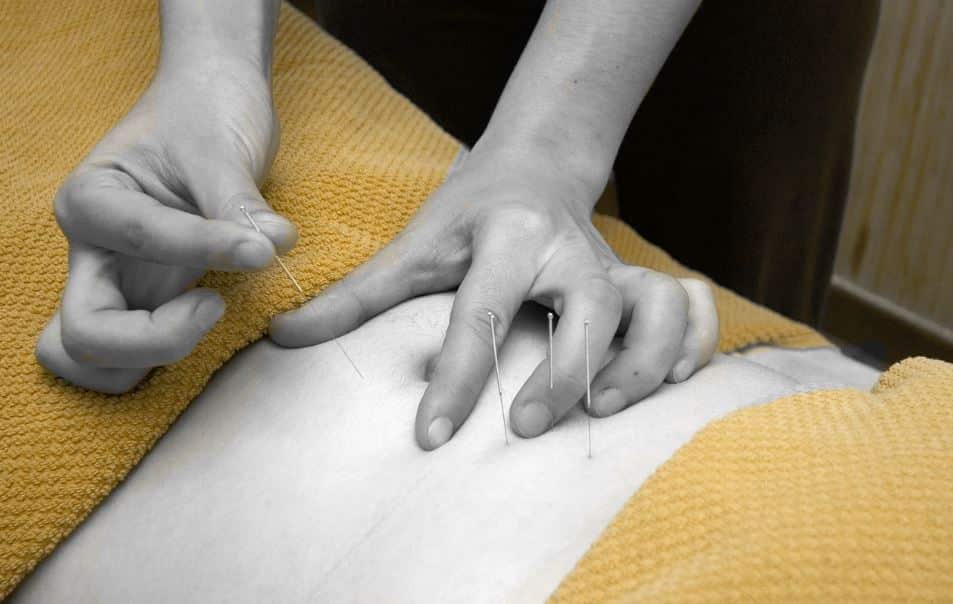 Acupuncture Ventre