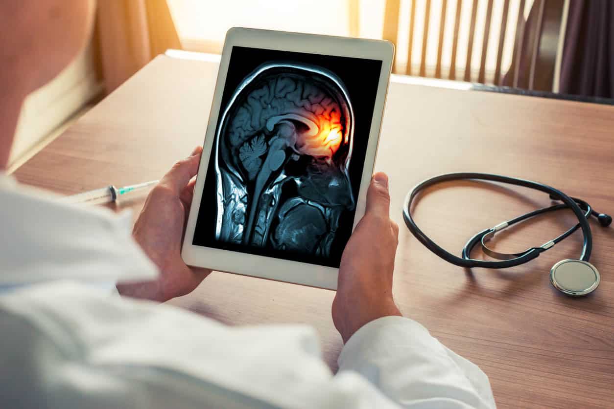 Doctor Holding A Digital Tablet With X Ray Of Brain And Skull Skeleton. Headache, Meningitis And Migraine Concept