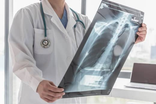 Docteur avec radiographie thoracique