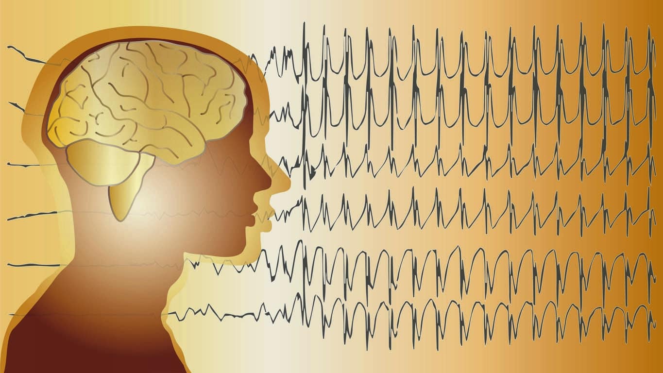 Fond médical cerveau Épilepsie