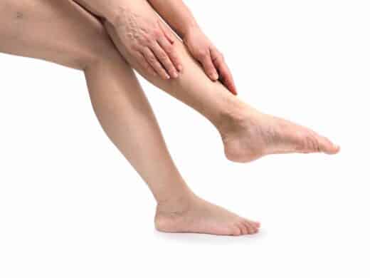 femmes touchant ses jambes lourdes